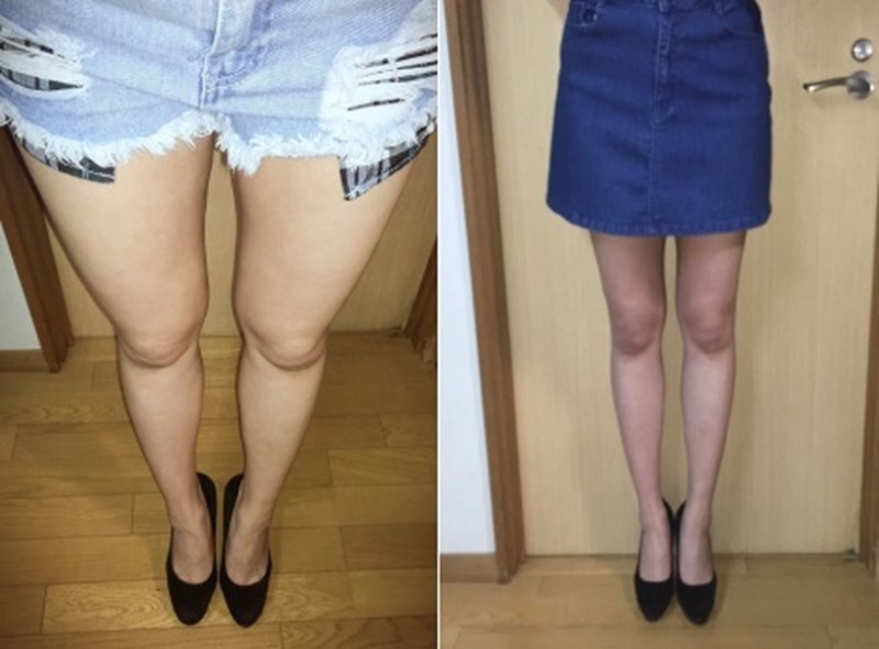 Boddy(バディ)の実績画像1